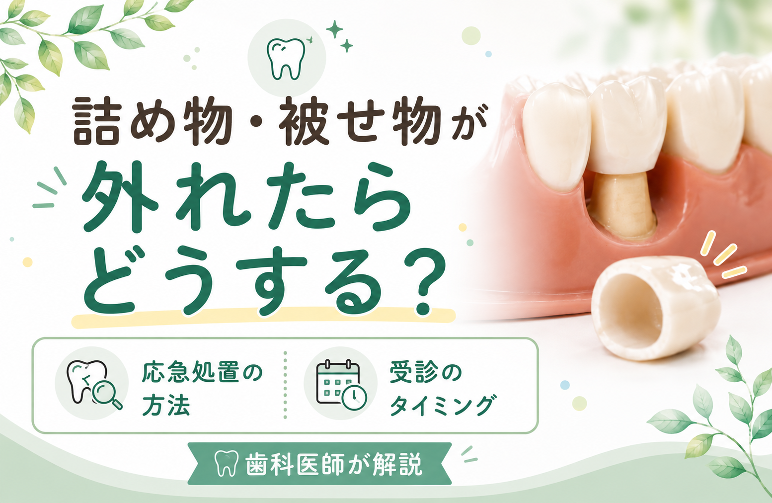 詰め物・被せ物が外れたらどうする？応急処置と受診のタイミングを歯科医師が解説
